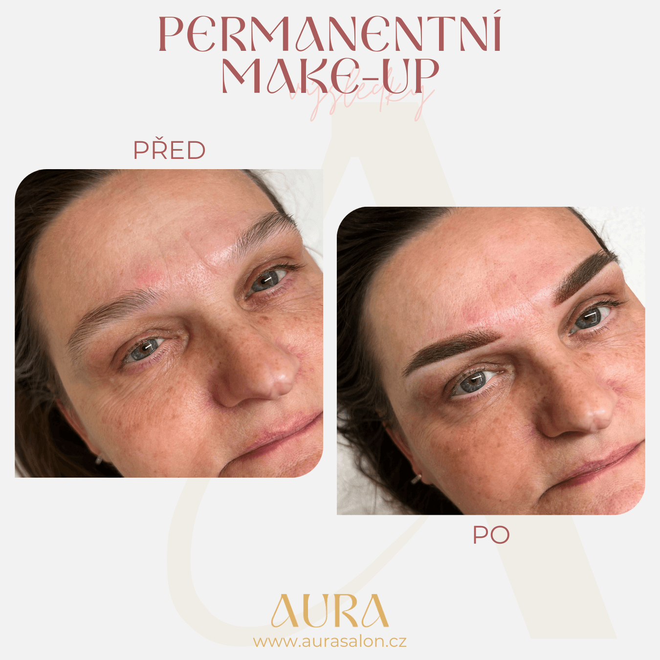 Before and after