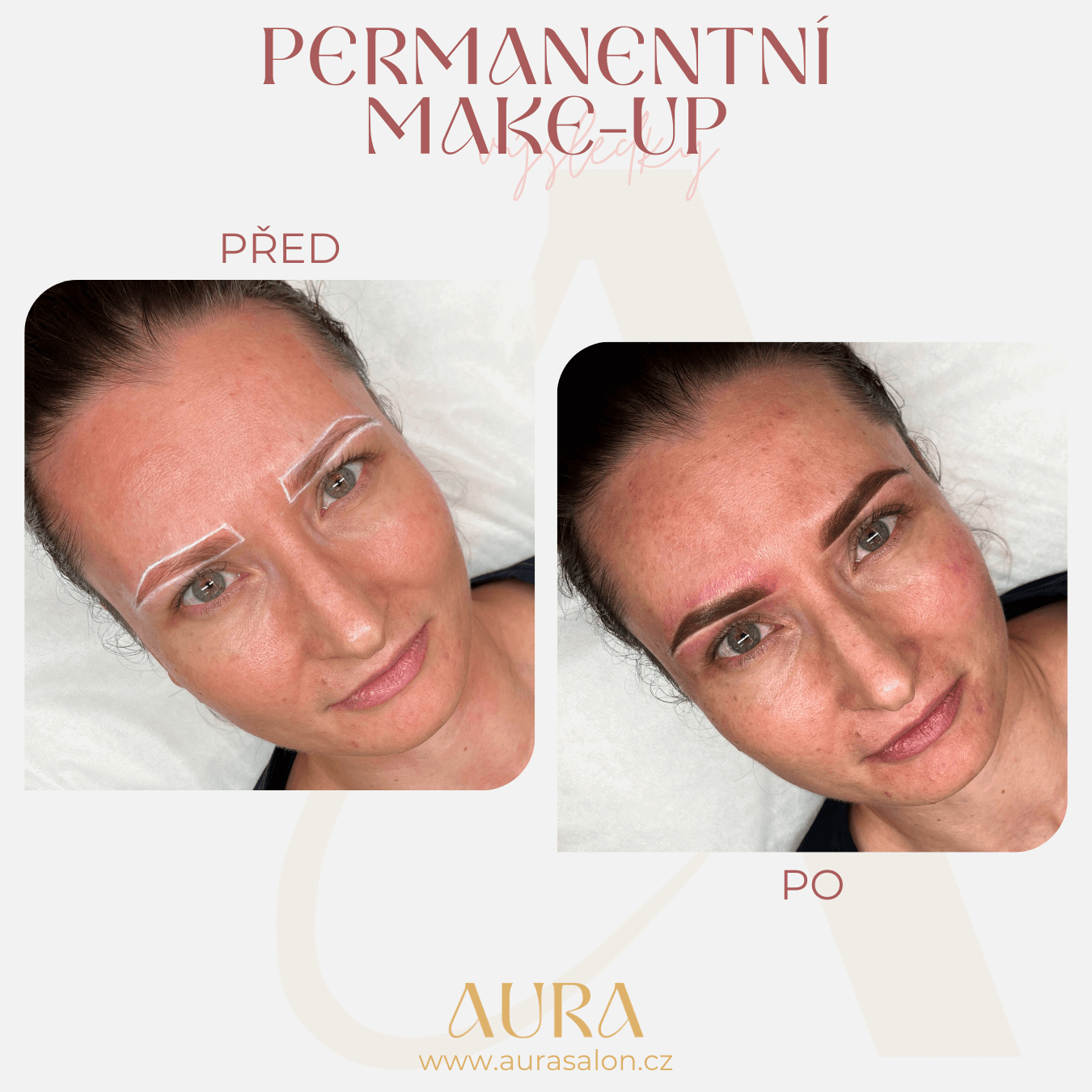 Before and after